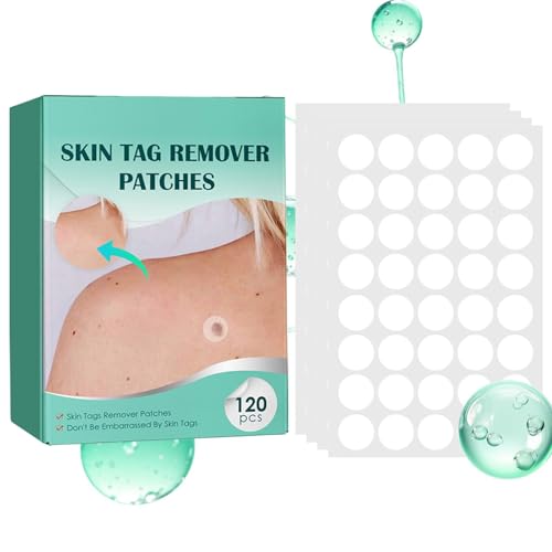 Removedor de topos de piel, 120 calcomanías hidratantes para la cara, parches para topos de piel, para limpieza de belleza, cara, cuello, espalda, hombros, manos, brazos, piernas, pies, viajes en casa