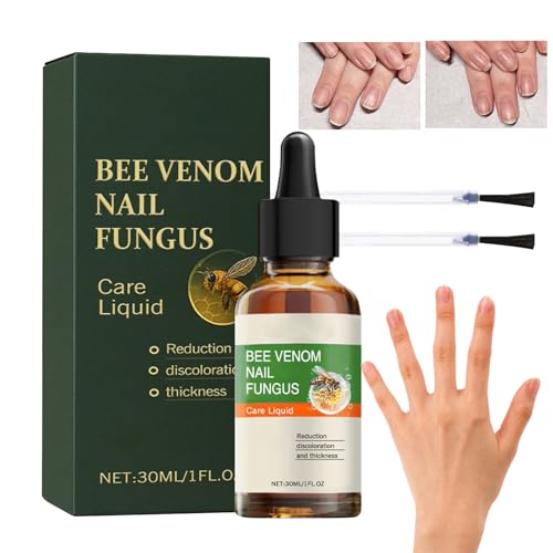 Tratamientos H-ongo Uñas, Sueros Eliminar H-ongo Uñas, Reparación U-ñas Dañadas Tratamientos H-ongos Pies Sueros, Limpieza Reparación U-ñas H-ongos Pies S-ueros, Para Hombres Y Mujeres