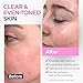 Ember Cloud Glycolic Acid Serum for Face 15% (1 Oz) - Advanced Formula to Support Skin Radiance, Addressing Uneven Tone & Fine Lines