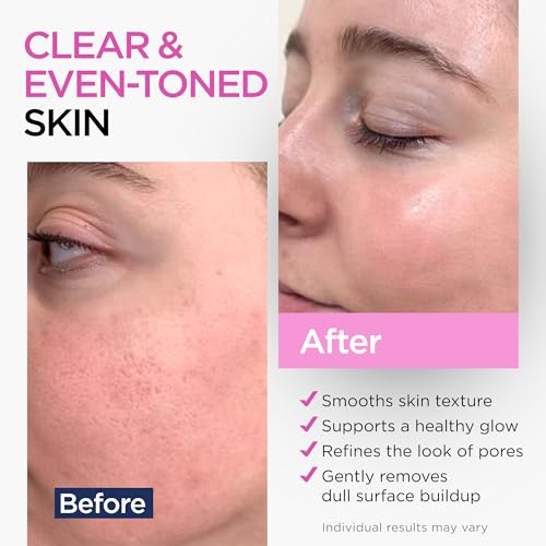 Image of Glycolic Acid Serum for Face 15%, Lactic Acid & Green Tea 2 Oz