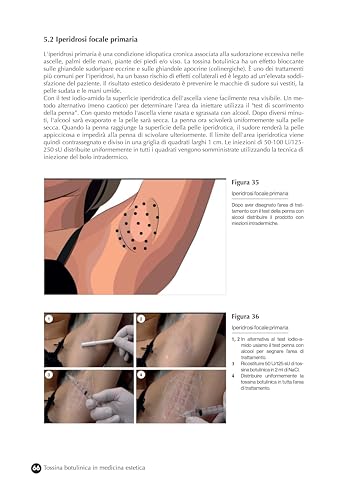 Tossina Botulinica In Medicina Estetica. Protocolli Iniettivi E Gestione Delle Complicanze - 3