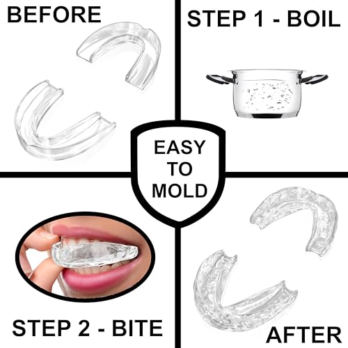 Anti Grinding Guard – Small Size for Women - Comfortable, Custom Fit, Non-Bulky, Moldable – (4) Teeth Grinding Guards & Case – Mouth Guard for Teeth Grinding, Woman Size - Small