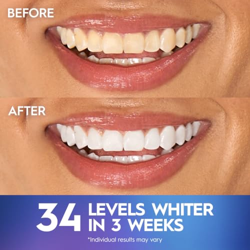 Image of Crest 3D Whitestrips Professional Effects + LED Light - Teeth Whitening Kit, 1 Light + 20 Treatments, Each with 1 Upper /1Lower, 40 Strips - Crest 3DWhite Teeth Whitening Strips
