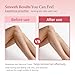 BreeMuse Hair Removal Cream for Women, Painless Depilatory Cream for Legs, Bikini Line & Underarms, Fast 5-10 Minute Body Hair Remover for Sensitive Skin with Moisturizing & Smoothing Formula