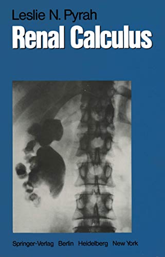 Renal Calculus view 2