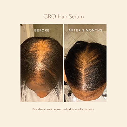 Vegamour Gro Hair Serum For Thicker, Visibly Longer Hair - Vegan Hair Growth Serum Designed For Thinning Hair & Hair Loss #TOP7