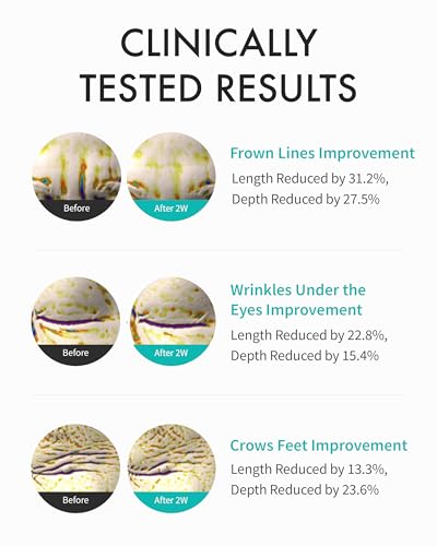 REJURAN® Intensive Eye Cream, c-PDRN® - Fast-Acting Eye Treatment for Wrinkles, Lifting, and Dark Circles. Instant Hydration and Visible Revitalization. Korean Skin Care (0.67 fl oz)