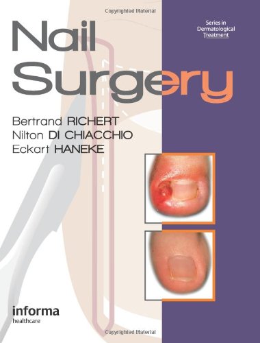 Nail Surgery (Series in Dermatological Treatment)