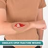 Open Fracture Wound Packing Trainer, Wound Dressing Training Model, Second Degree
