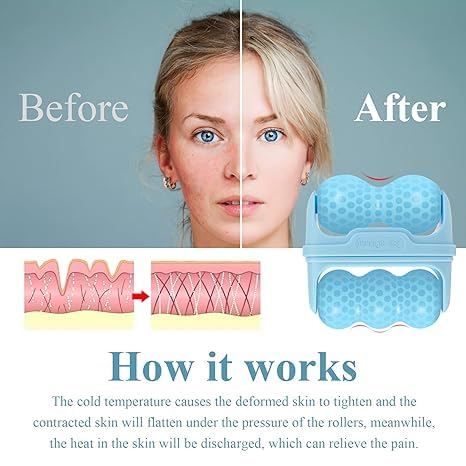 Kostech Derma Roller 0.25mm With 540 Titanium Alloy Needles | Promotes Beard Growth, Hair Regrowth & Sillicon Ice Roller for Face and Eye Massager Roller (Sillicon Ice Roller, 0.25MM) 3