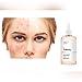 The Ordinary Glycolic Acid 7% Toning Solution 240ml The Ordinary Glycolic Acid 7% Toning Solution 240ml