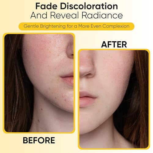 Turmeric Kojic Acid Cleansing Pads, 50 Pcs Kojic Acid And Turmeric Cleansing Pads for All Skin Types, Exfoliating Cotton Rounds, Dark Spots Remover for Face, Deep Clean Pores - Image 4