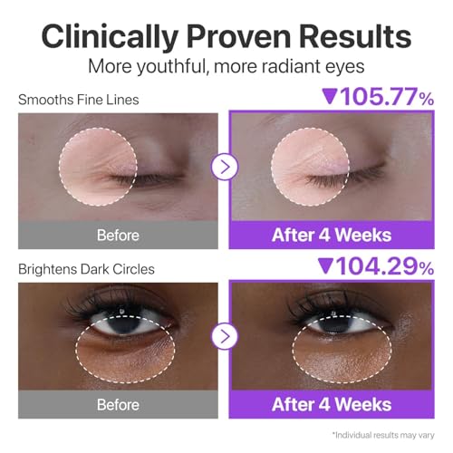 Image of No.9 NAD+ Retinol Peptide Eye Cream 15 ml Retinol Under Eye Serum Dark Circles, Fine Lines Wrinkles Hydrating, Firming Brightening Peptides Niacinamide Glow Treatment Daily Use Under Eye Care