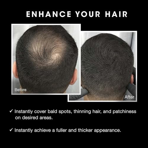 Pacinos Hair Fiber Kit - Conceal Thinning Hair Instantly with Fiber Hold Spray - Black