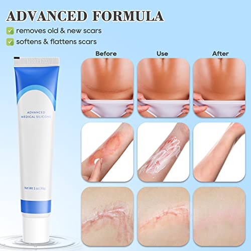 Silicone Scar Gel, Scar Cream, Scar Removal And Treatment Cream For Keloids, C-Section, Burn, Surgery, Acne - Physician Formulated Silicone Without Water. Effective For Old And New Scar #TOP3