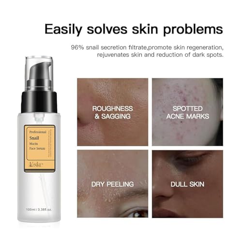 Snail Mucin Serum, Snail Secretion Filtrate, Snail Mucin, Power Repairing Essence