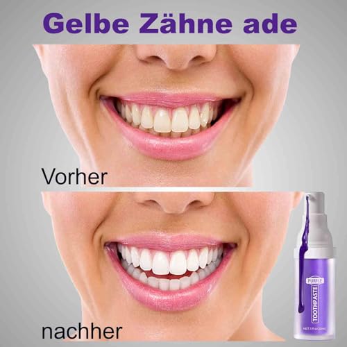 Lila Zahnpasta Weisse Zähne,Purple Teeth for Whitening Teeth,Lila Zahnpasta weiße zähne Heidelbeergeschmack 30ml