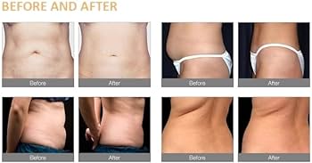 Amazon.co.jp: クリオリポリシスマシン 脂肪冷凍マシン 脂肪凍結処理