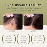 Batana Oil For Hair Growth - 100% Pure, Raw & Natural Blend With Organic Castor, Pumpkin Seed, Coconut and Rosemary Oil - Thicker, Stronger Hair Gifts For Men & Women Scalp (1 Pack) - Image 3