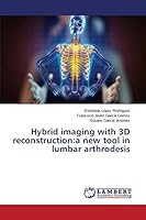 Hybrid imaging with 3D reconstruction: a new tool in lumbar arthrodesis 3659789348 Book Cover