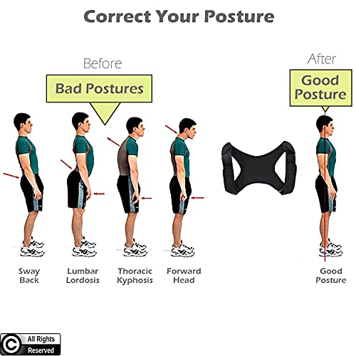 POAGL Adjustable Posture Corrector Brace for Men – Universal Fit Upper Back, Shoulder & Clavicle Support, Helps Improve Posture & Relieve Neck, Shoulder & Back Pain (Patented Design)