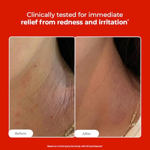 Image of Conscious Chemist HOCL Skin Relief Face & Body Spray | 100ml | Soothing & Repairing Toner | Hypochlorous Acid Mist for Quick Relief from Body Odour, Acne, Redness & Irritation | Soothes Sensitive & Irritated Skin, Suitable for All Skin Types | men & Women
