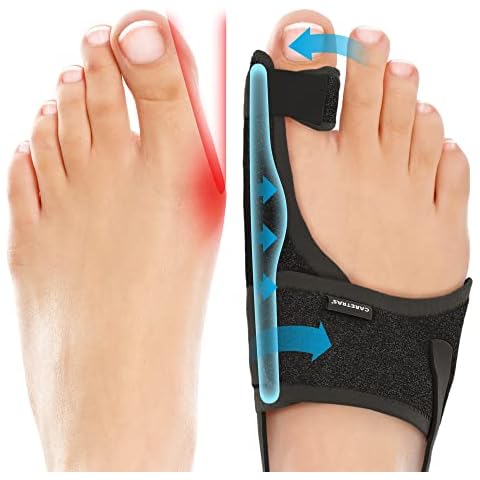 Caretras Bunion Corrector 2pc Cover