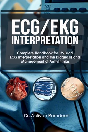 ECG/EKG Interpretation: Complete Handbook for 12-Lead ECG Interpretation and the Diagnosis and Management of Arrhythmias (The Lifeline Learning Series (TLLS))