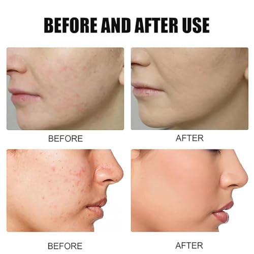 HFDHD Brolamen Ginseng Tonico Essenza Antirughe