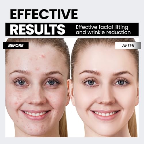 Hunvva HUNVVA-BLACK Microcurrent Facial Device,Latest Red Light Technology,Enhances The Ability To Lift The Face And Tighten The Skin,Facial Wrinkle Equipment,Smart Photon Micro-Current Device,Model:Ep-300. thumb #3