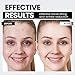 Microcurrent Facial Device,Latest Red Light Technology,Enhances The Ability to Lift The Face and Tighten The Skin,Facial Wrinkle Equipment,Smart Photon Micro-Current Device,Model:EP-300. (Black)