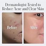 Geologie 2% Salicylic Acid Face Wash Bergamot + Juniper Scent | Facial Cleanser for Men & Women | Acne & Oil Control | Deep Cleansing & BHA Exfoliating Face Wash | 2-Pack - Image 4