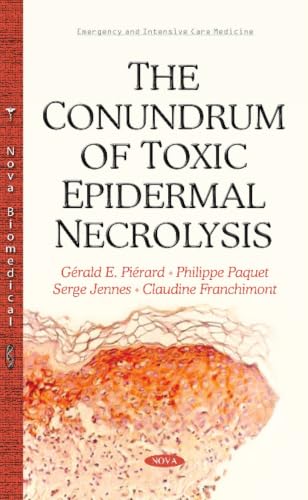 The Conundrum of Toxic Epidermal Necrolysis