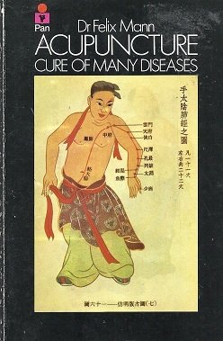 Acupuncture: Cure of Many Diseases