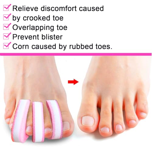 Image of 8 Pieces Premium Foam Toe Separators - Toe Spacers for Corn, Blister, and Hammer Toe Relief