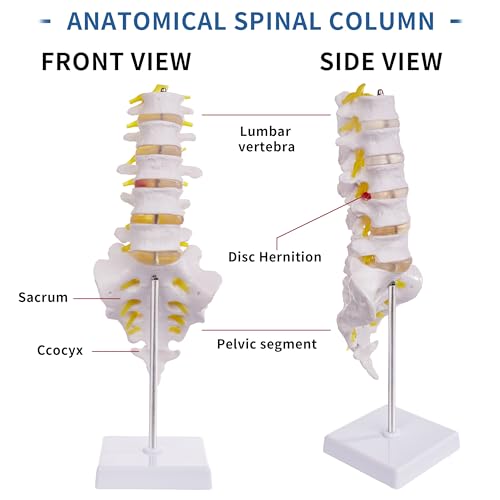 Image of Lumbar Spine Model for Anatomy Education, Life Size Human Lumbar Model with 5 Vertebrae Sacrum, Spinal Disc, and Sturdy Base, Ideal Tool for Medical Teaching and Learning
