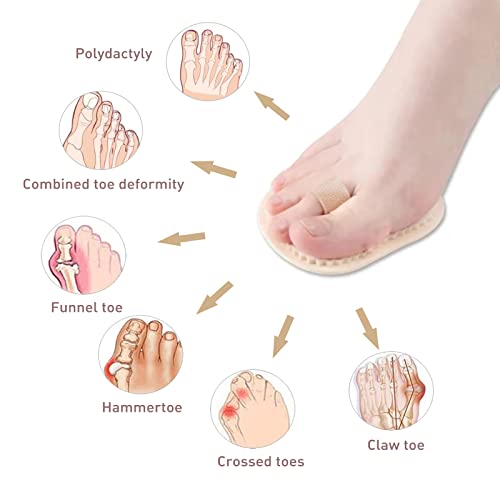 Aphrordity 2 Pieces Toe Straightener Hammer Toes, Hammer Toe Splint, For Bunion Curve, Overlapping Hammer For Men And Women Budin Splint #TOP2