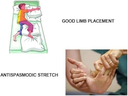 Miniatura 4 de Ortesis dedo dispositivo de entrenamiento de dedo rehabilitación robot guantes para rehabilitación Alivia el dolor del túnel carpiano noche