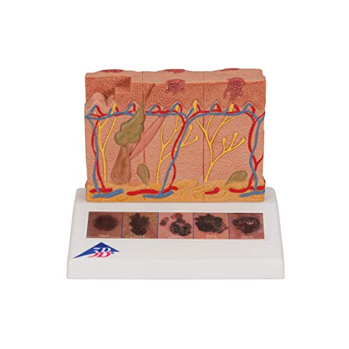 3B Scientific J15 Modelo de anatomía humana Modelo de Cáncer de Piel + software de anatomía gratuito - 3B Smart Anatomy Cover