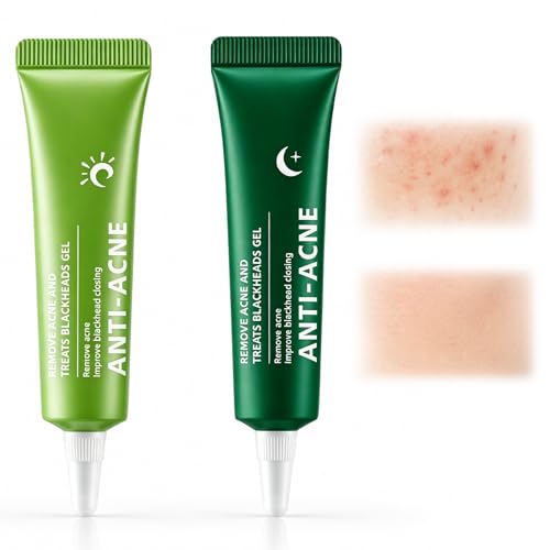#VerdientProvisionen<br>20g Gesichtspflege Gel Klärendes Gesichtsgel bei Hautunreinheiten HautPflege gel Für Männer und Frauen Für alle Hautarten geeignet Sichtbar verbessertes Hautbild