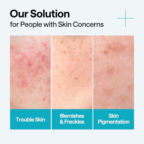 Mediheal Madecassoside Repair Serum 1.35 fl.oz - Blemish Care, Fades Pigmentation and Freckles & Skin Soothing & Hydration - with Centella Asiatica, Niacinamide