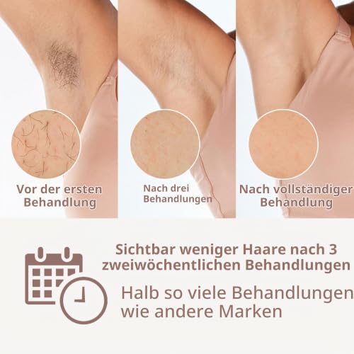 Philips Lumea IPL Prestige, 2 Attachments - Hair Removal Device (BRI944/00) – Ansicht 2