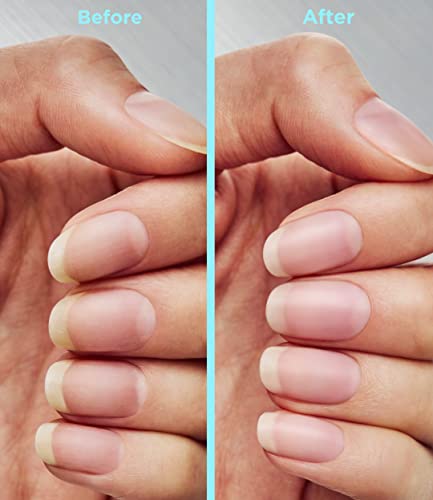 Sally Hansen Repair + Rescue Insta-Smooth Ridge Filler #TOP6