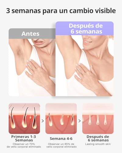 Descubre la mejor manicura y pedicura de LugoPulsa aqui 👈🏼 y pide cita Depiladora-Laser-Hielo-Zafiro-10-Minutos-de-Depilacion-de-Cuerpo-Completo-9-Niveles-y-21J-Depiladora-Luz-Pulsada-Indolora-para-Mujeres-Hombres-Bikini-Cara-Cuerpo