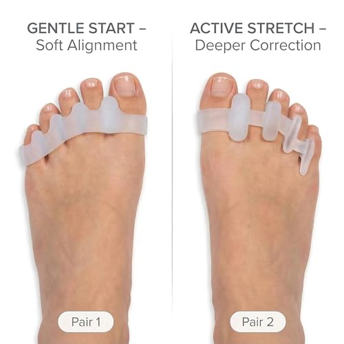 Image of Cetaplast Bunion Corrector and Toe Straightener (2 Pairs) - Medical Grade Silicone Toe Separators for All-Day Pain Relief & Alignment - Includes Pairs for Gentle Start & Active Stretch Support for Men & Women