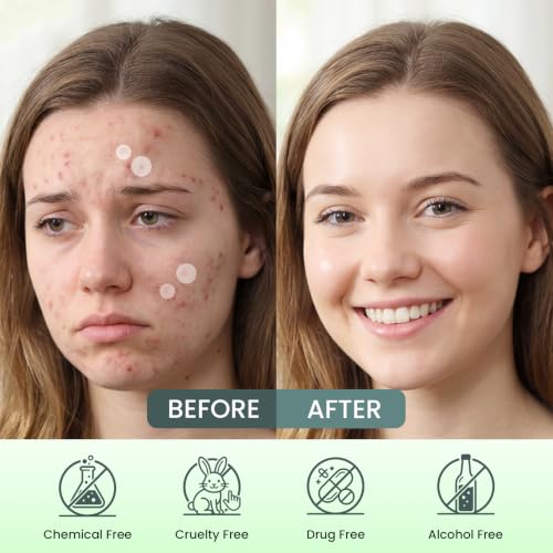 BWLIY Facial Pimple Patches, 2 Sizes, 144 Counts: Acne Patches, Hydrocolloid Patches for Covering Spots and Blemishes, Spot Patches Absorbs Fluid, Reduces Redness, Vegan, Cruelty-Free Skincare — view 5