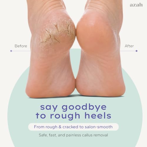 Image of Azah Callus Remover For Feet| Electric Foot Filer For Pedicure | Smooth, Soft Feet In Minutes | IPX6 Waterproof | Electric Hard Skin Remover For Feet | Includes 3 Replaceable Rollers | 1 Year Warranty