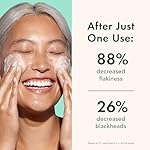 Rael Face Wash, Miracle Clear – Gentle Exfoliating Cleanser with Succinic Acid & Minerals, Korean Skin Care (5 fl oz) - Image 5