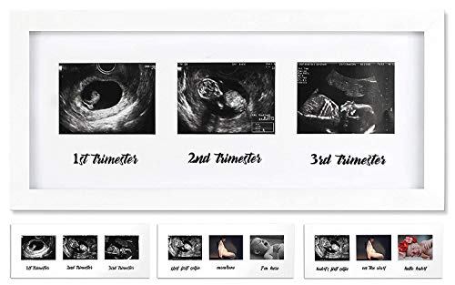 Image of IHEIPYE Triple Sonogram Pregnancy Frame - Baby Ultrasound Picture Frame for Expecting Parents, Gender Reveal Party, Baby Nursery Decor, White
