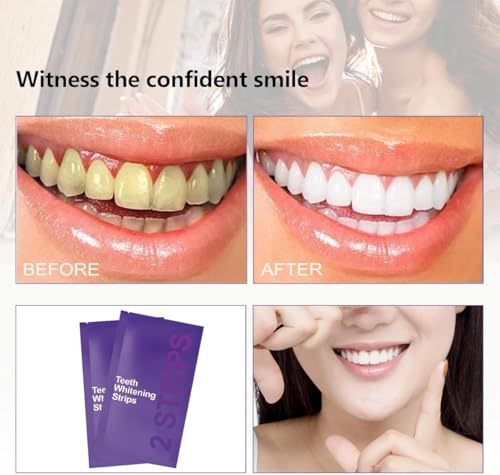 HAV CREATION Purple Teeth Whitening Strips, 28 Strips - Image 7